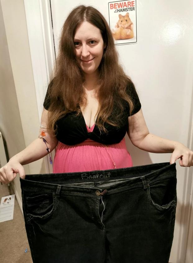 The Argus: Michelle lost a lot of weight because of her condition