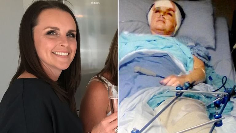 Rachel was seriously injured after her ex-husband shot her